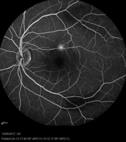 Retinal laser course