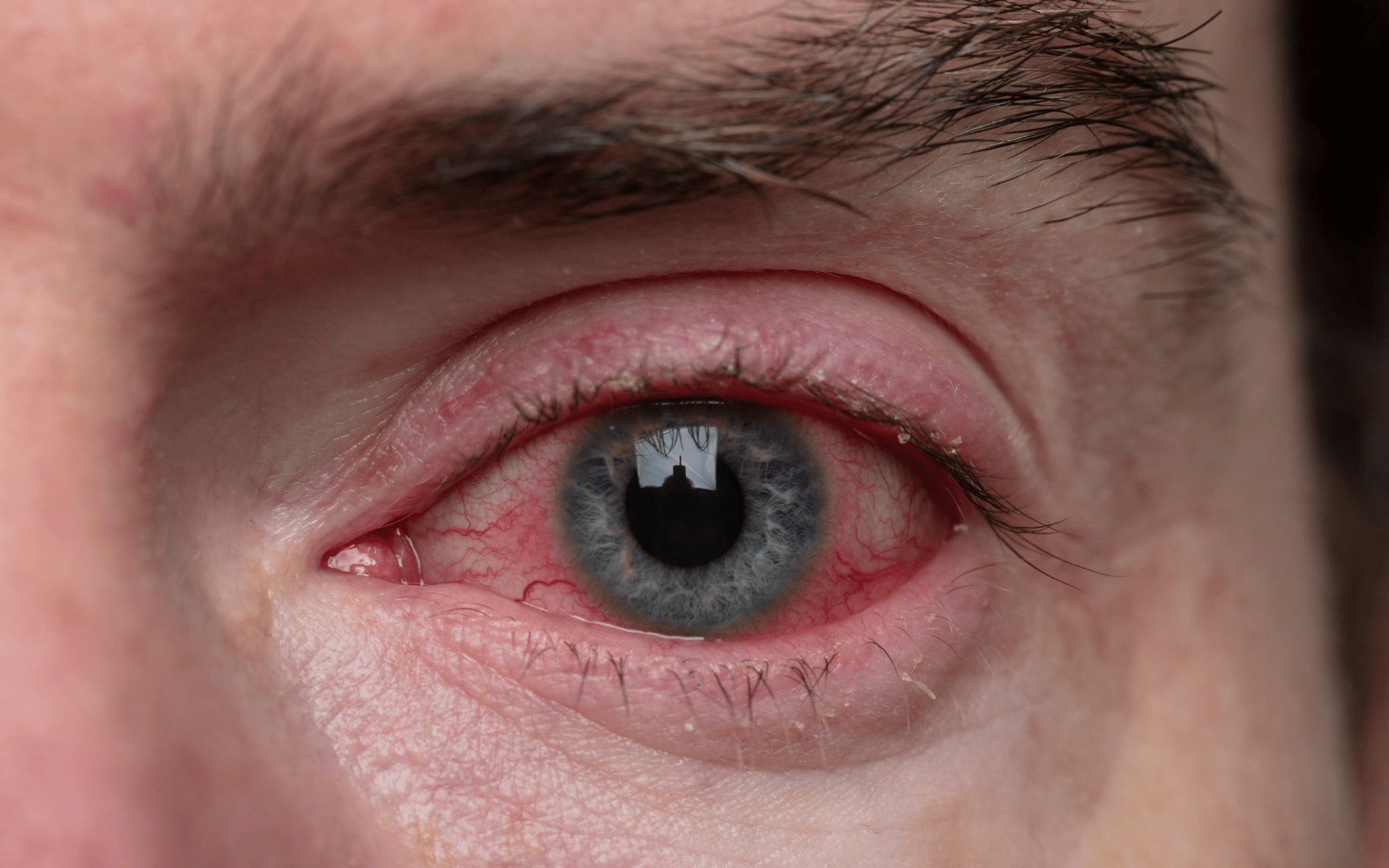 Urgent care in ophthalmology for the multi-professional workforce programme