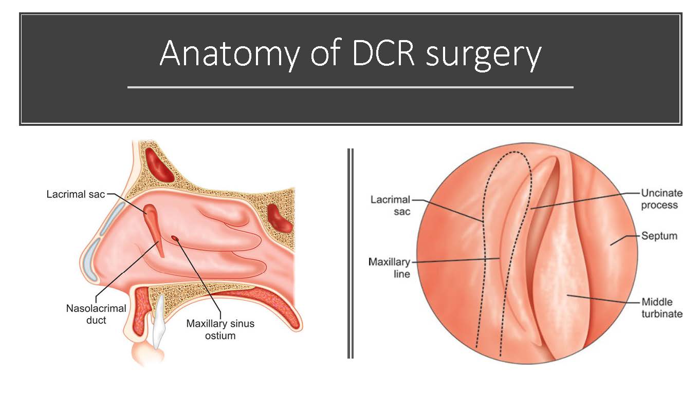 Endonasal Dacryocystorhinostomy (DCR) hands-on simulation course for ophthalmology trainees